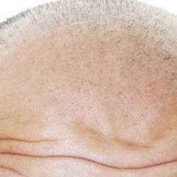 درمان ریزش مو با چند روش خانگی