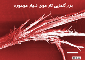علل موخوره و درمان آن با چند روش ساده