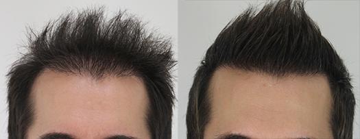 عادتهای نادرستی که باعث ریزش مو میشوند
